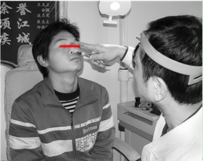 系帶過長過短手術